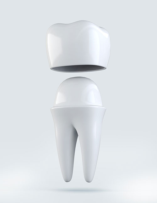 3D illustration of Crown tooth on white background