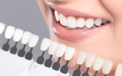 Woman smiling and comparing teeth whiteness to scale