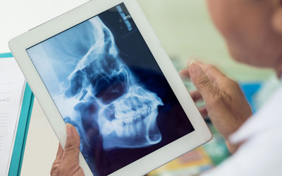 Dentist examining dental xray