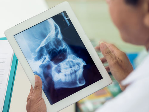 Dentist looking at jaw x-ray